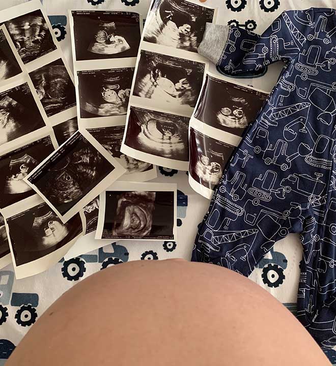 Pregnant Mom with Ultrasounds